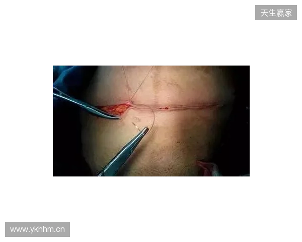 广州豹官方:杨浩眉弓伤口缝合30余针,预计5-7天后拆线 广州豹官方:杨浩眉弓伤口缝合30余针,预计5-7天后拆线